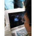 laptop ultrasound scanner, portable ultrasound for pet hospital DW-500